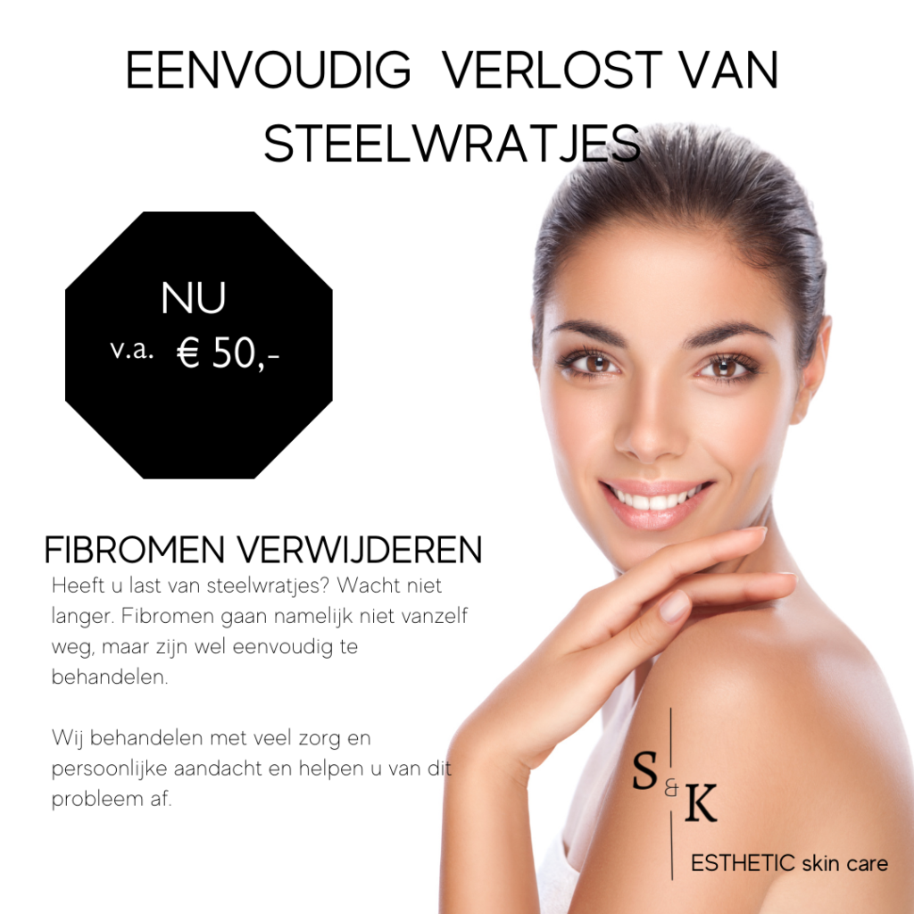 Fibromen - Last van fibromen laat deze verwijderen fibromen verwijderen almere steelwratjes verwijderen almere