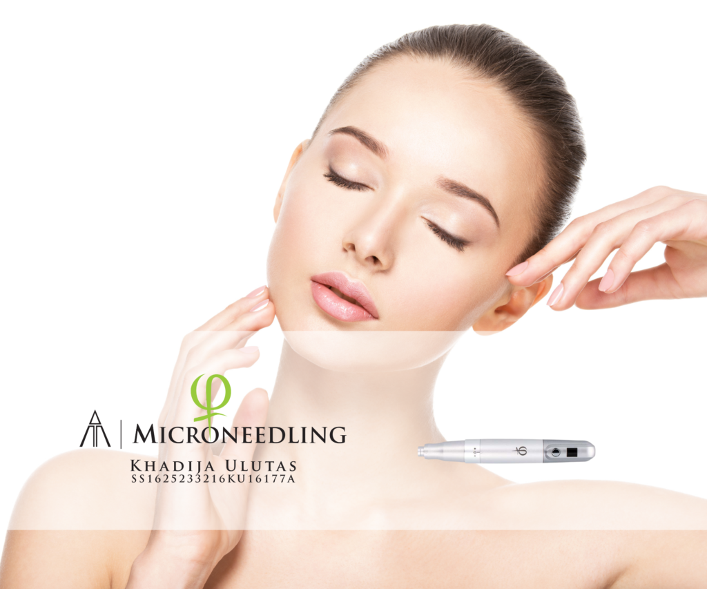 De beste en goedkoopste microneedling in Almere.