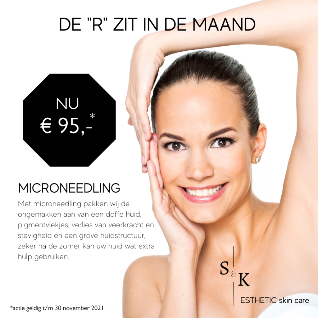 Microneedling - De r is in de maand herst aanbiedimng microneedling in almere