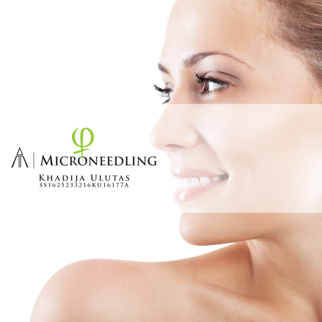 De beste Microneedling in Almere